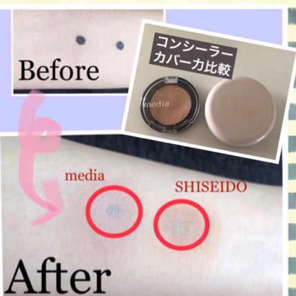 スポッツカバー ファウンデイション/SHISEIDO/クリームコンシーラーを使ったクチコミ(1枚目)