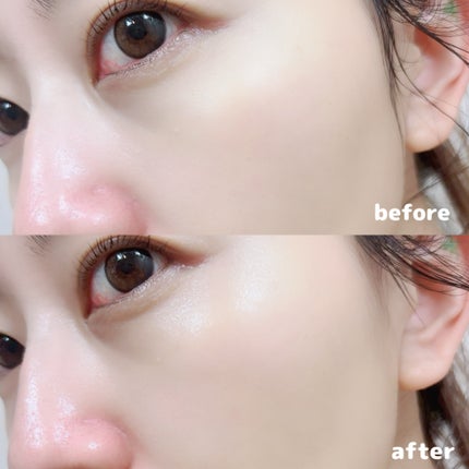 ナインセラム/Dr.Twenty Project/美容液を使ったクチコミ(4枚目)