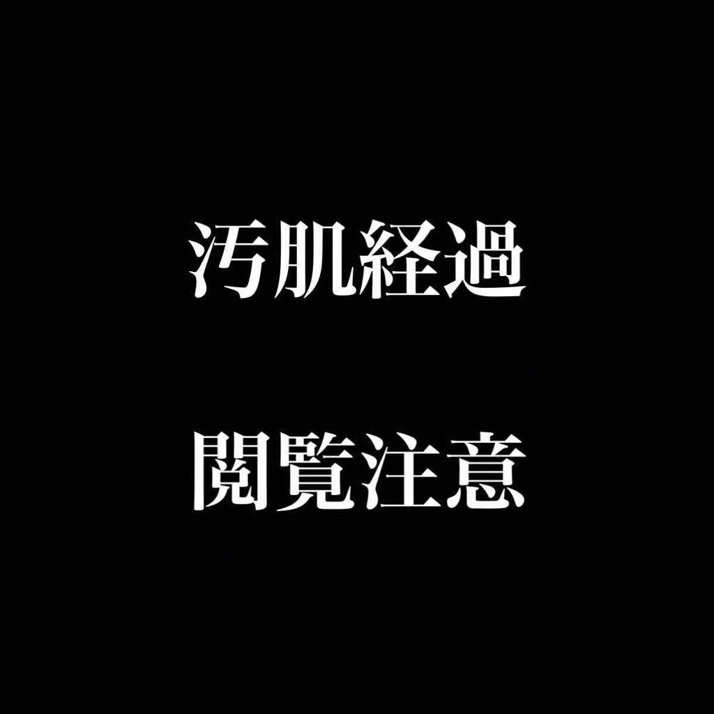明色美顔水 薬用化粧水/美顔/化粧水を使ったクチコミ（1枚目）