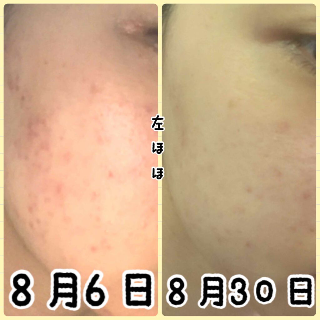 DHC はとむぎエキス/DHC/健康サプリメントを使ったクチコミ(3枚目)