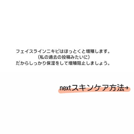 モイスチャライジングローション/セタフィル/ボディローションを使ったクチコミ(3枚目)