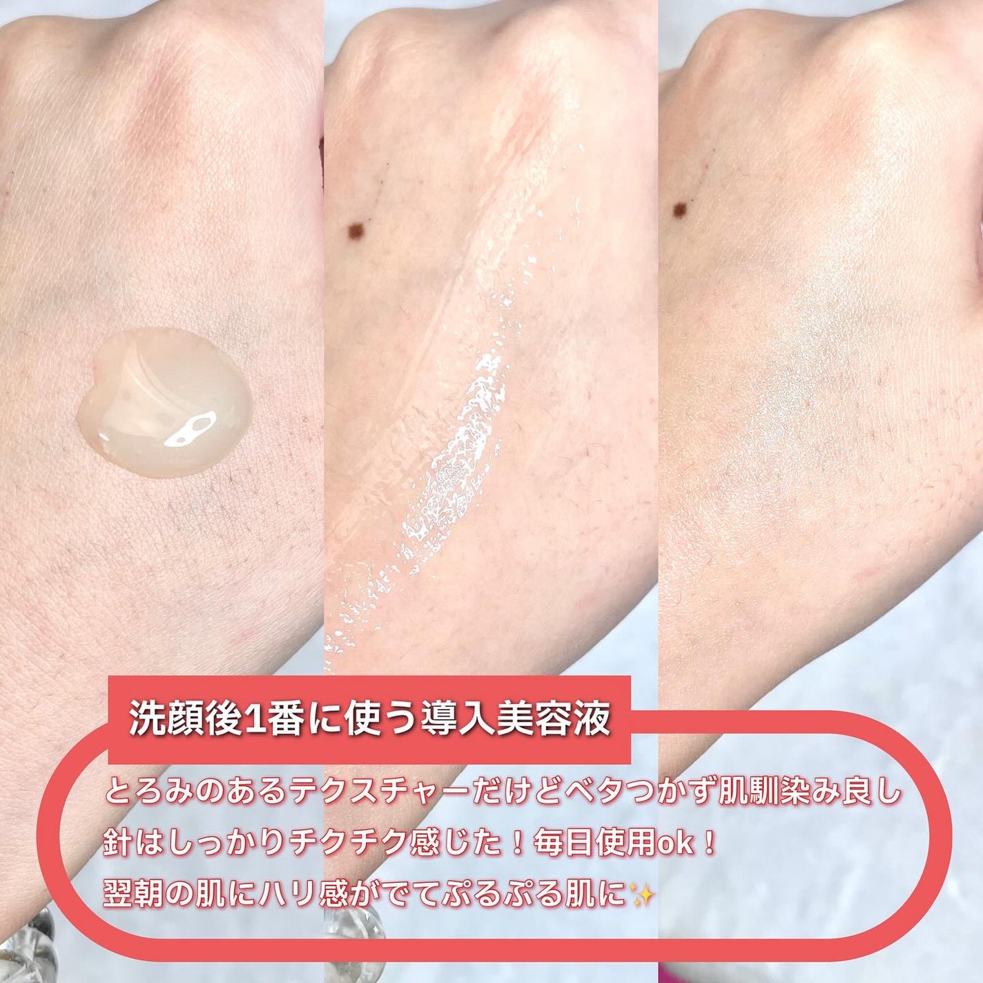 PDRNショット675/COSNORI/美容液を使ったクチコミ(4枚目)