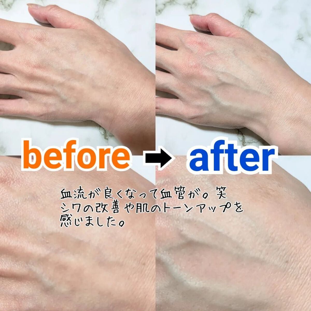 レチノール0.1%クリーム/Frankly/フェイスクリームを使ったクチコミ(2枚目)