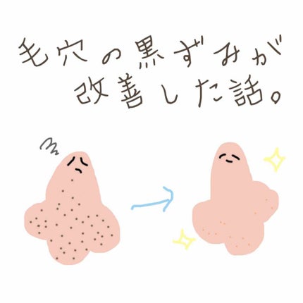 コールドクリーム/ウテナモイスチャー/クレンジングクリームを使ったクチコミ(1枚目)