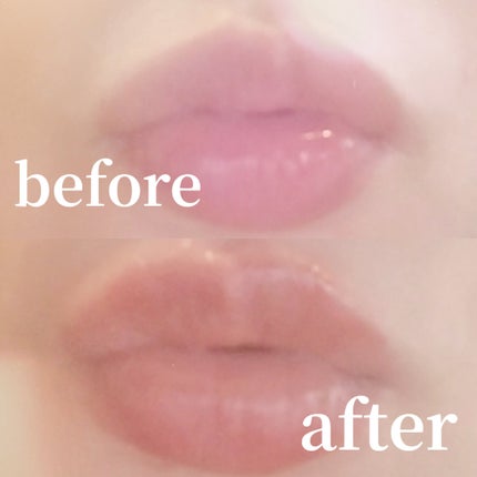 ドトムリッププラスプランパー/keybo/リッププランパーを使ったクチコミ(4枚目)