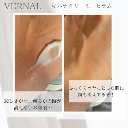 試してみた】ヴァーナル キハナクリーミーセラムの効果・肌質別 試してみた】ヴァーナル キハナクリーミーセラムの効果・肌質別
