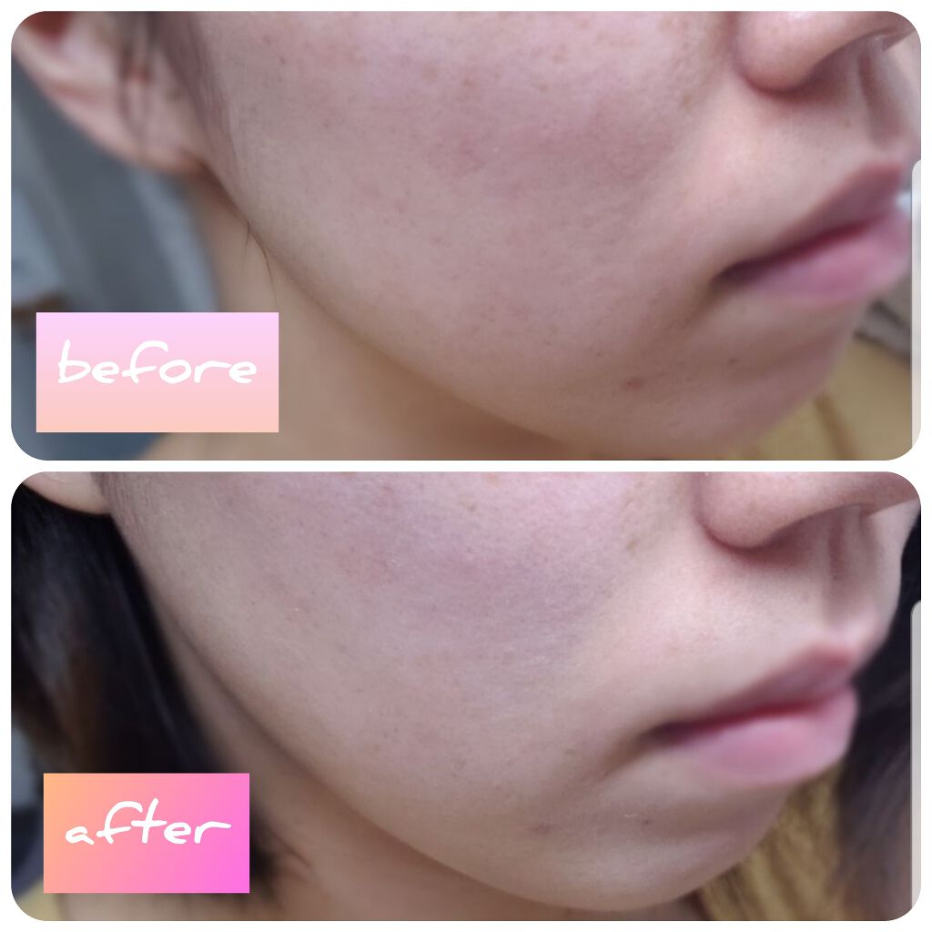 すっぴんパウダー/クラブ/プレストパウダーを使ったクチコミ(3枚目)