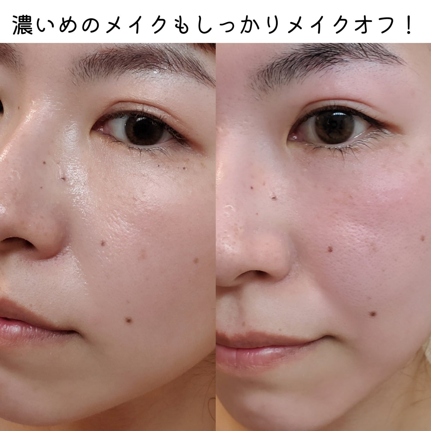 グリーンディープポアクレンジングバーム/Dr.G/クレンジングバームを使ったクチコミ(7枚目)