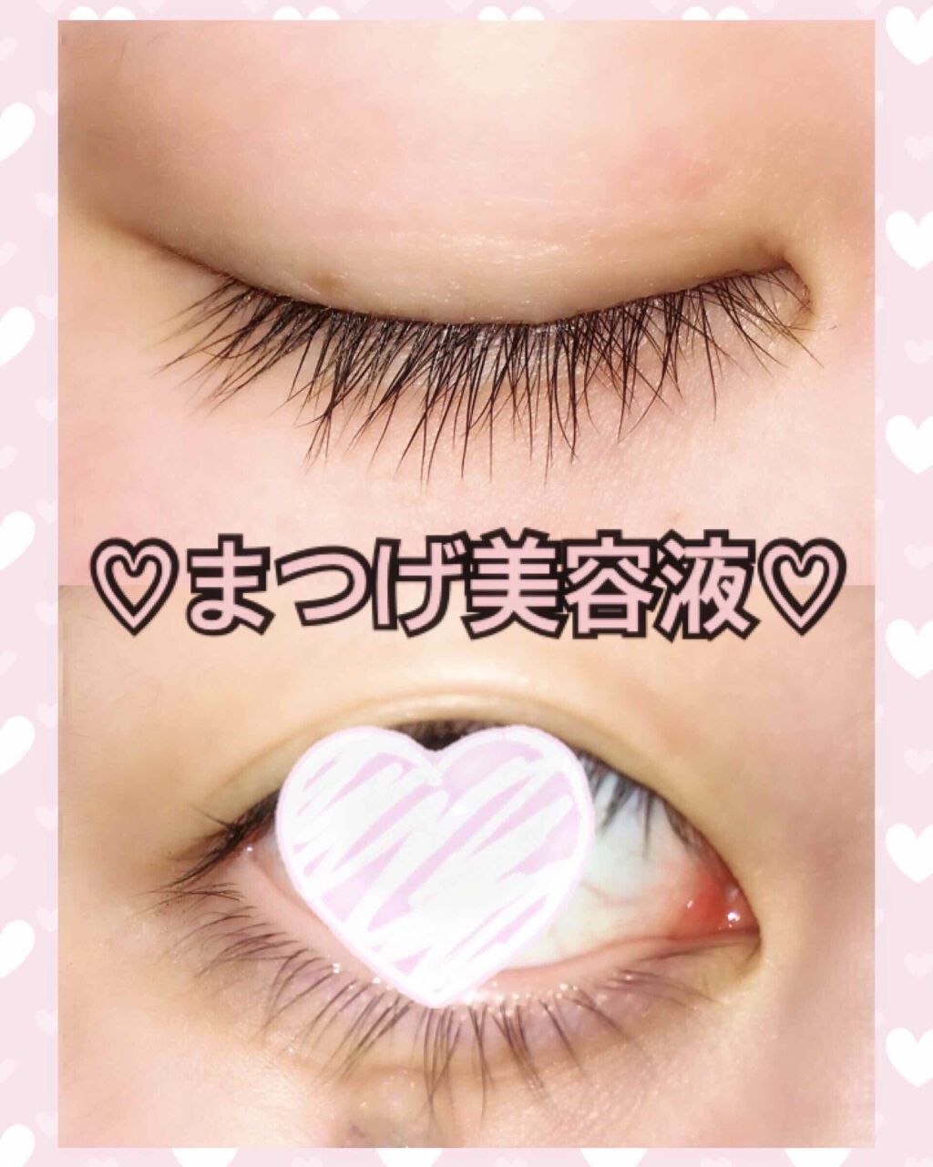 アデノバイタル アイラッシュセラム/資生堂プロフェッショナル/まつげ美容液を使ったクチコミ(1枚目)