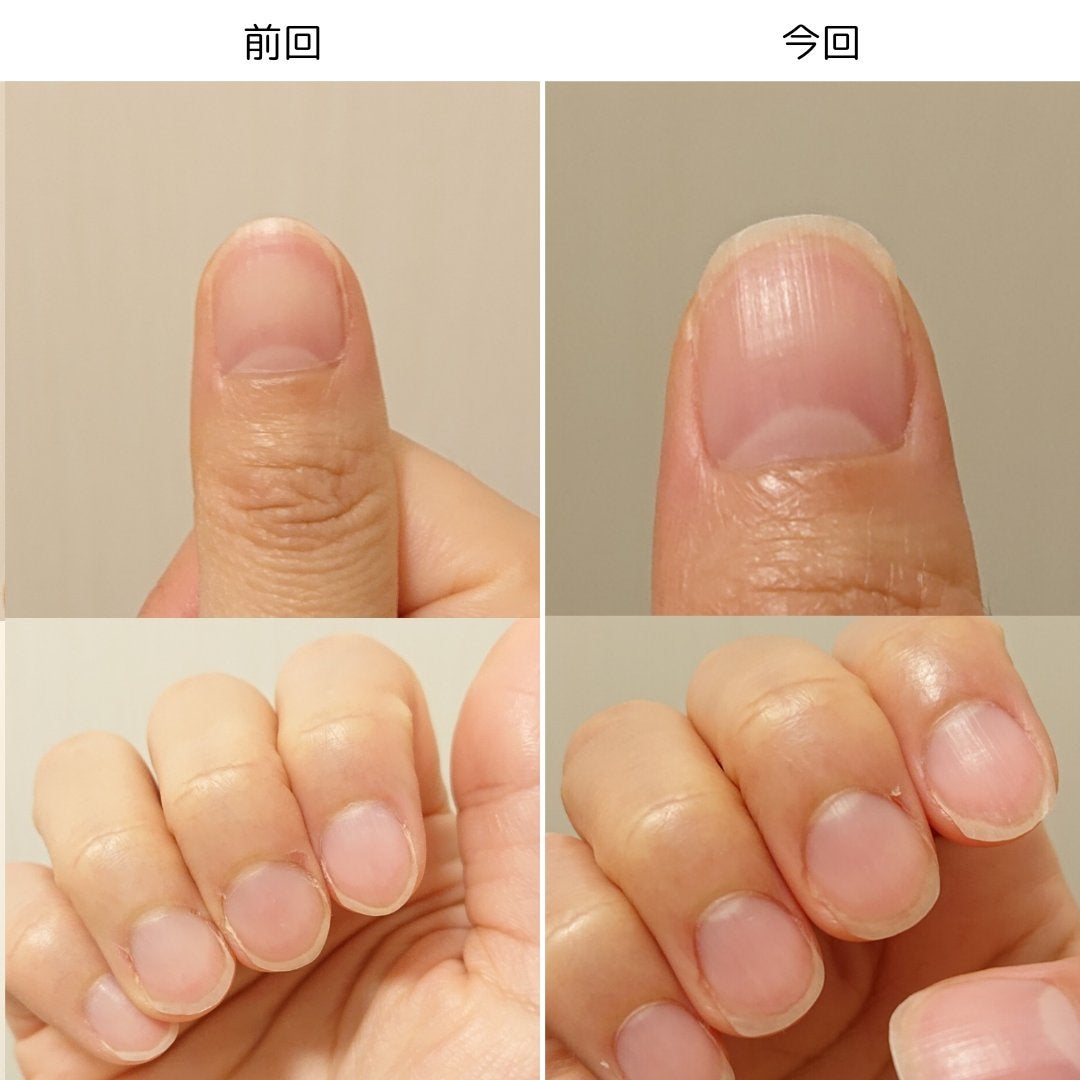 ネイルベッドオイル/アンドネイル/ネイルオイル・トリートメントを使ったクチコミ(4枚目)