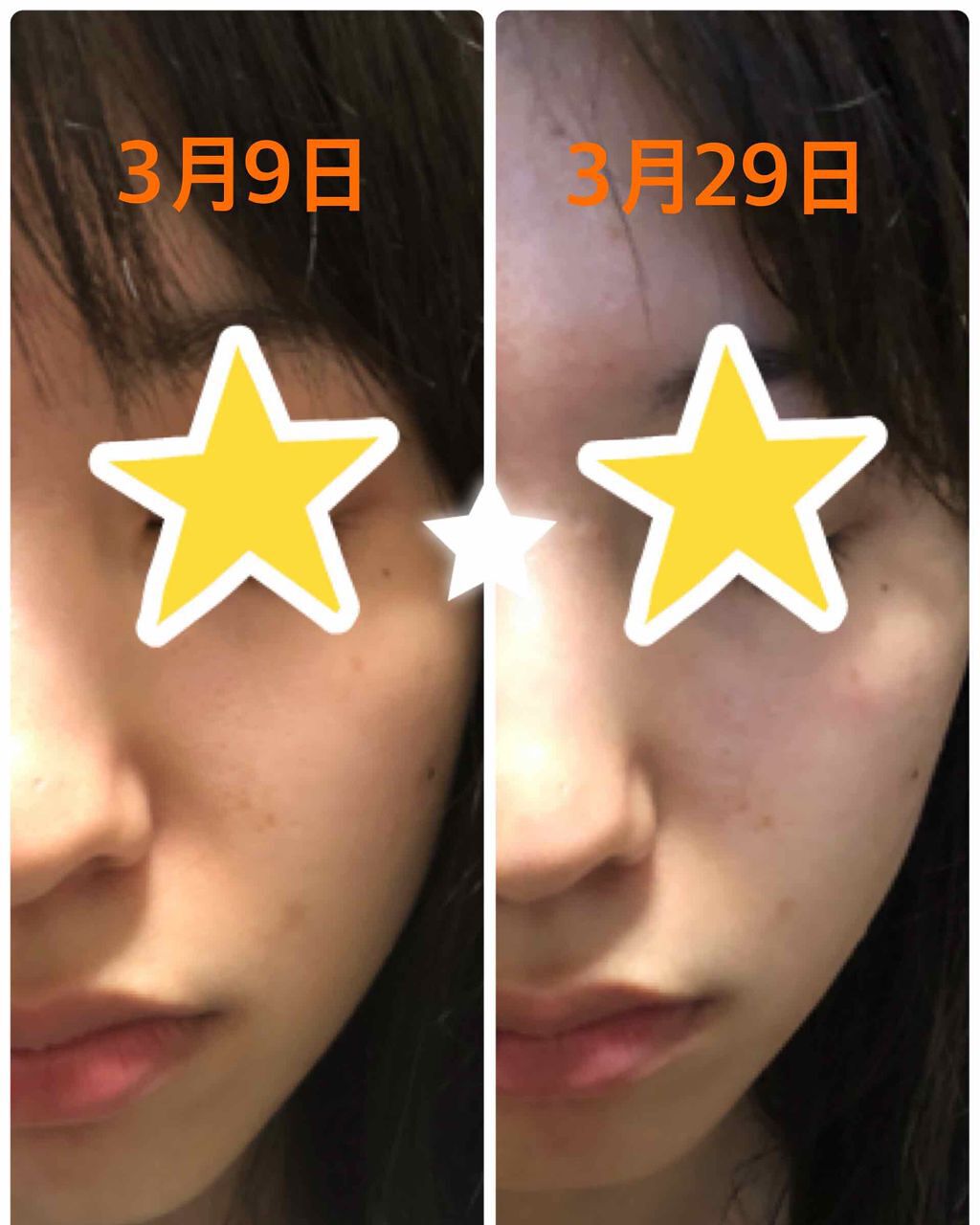 ホワイトアップ ローション(I)/アクアレーベル/化粧水を使ったクチコミ（2枚目）