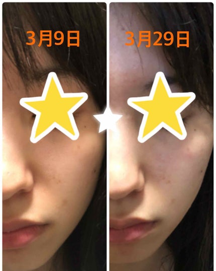 ホワイトアップ ローション(I)/アクアレーベル/化粧水を使ったクチコミ(2枚目)