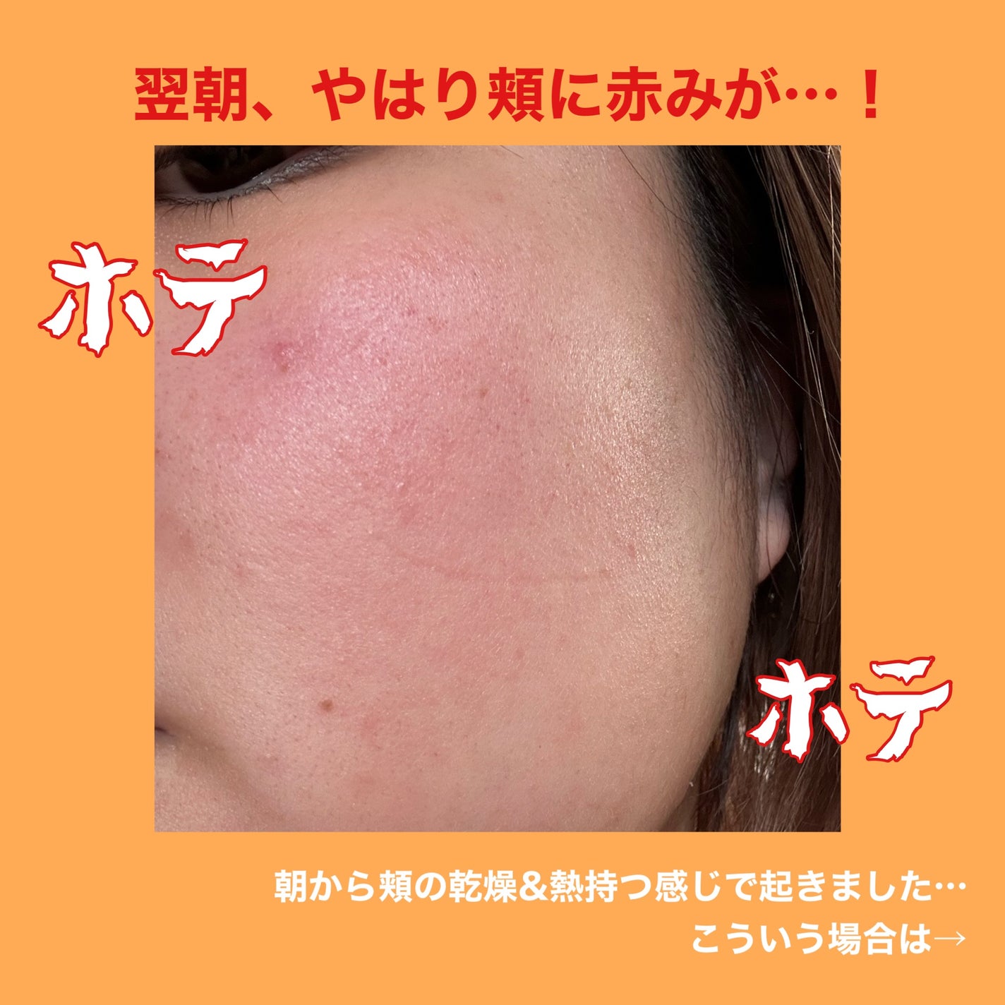 薬用しみ対策 美白乳液【医薬部外品】/メラノCC/乳液を使ったクチコミ(3枚目)