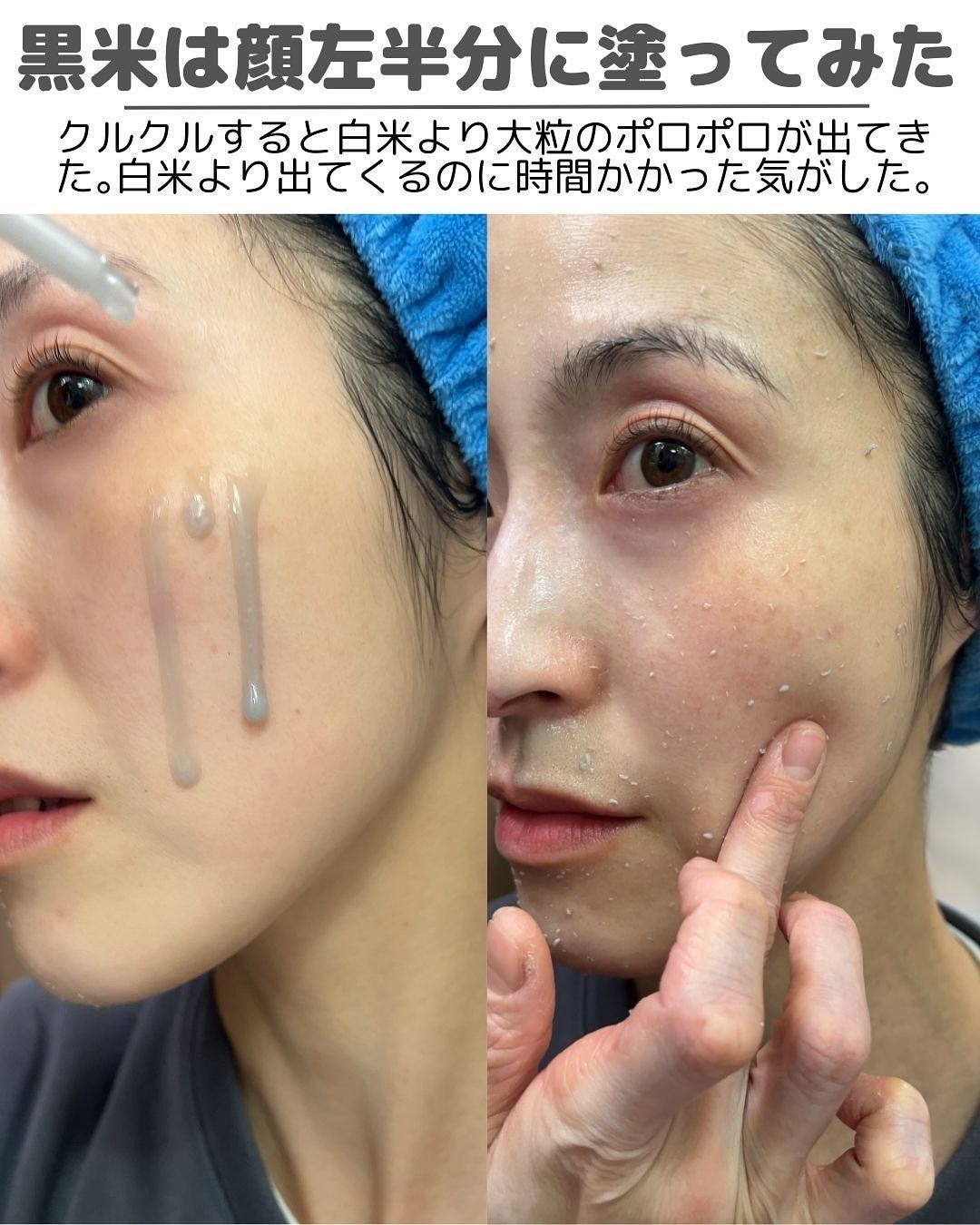 白米ピールショットゴマージュアンプル/Dr.Melaxin/美容液を使ったクチコミ(6枚目)