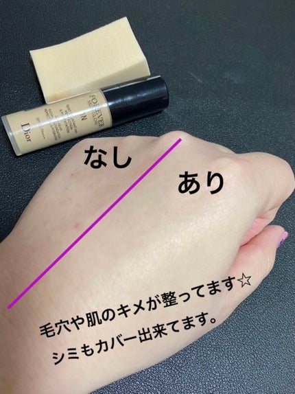 ディオールスキン フォーエヴァー フルイド グロウ/Dior/リキッドファンデーションを使ったクチコミ(2枚目)
