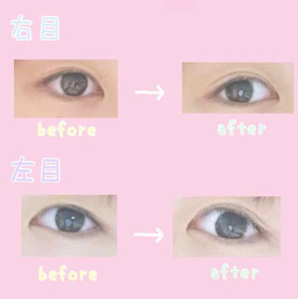 アイトーク/アイトーク/二重まぶた用アイテムを使ったクチコミ(4枚目)