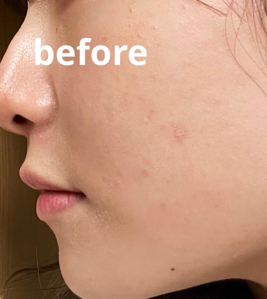 グルタチオングロウアンプル/MEDICUBE/美容液を使ったクチコミ(2枚目)