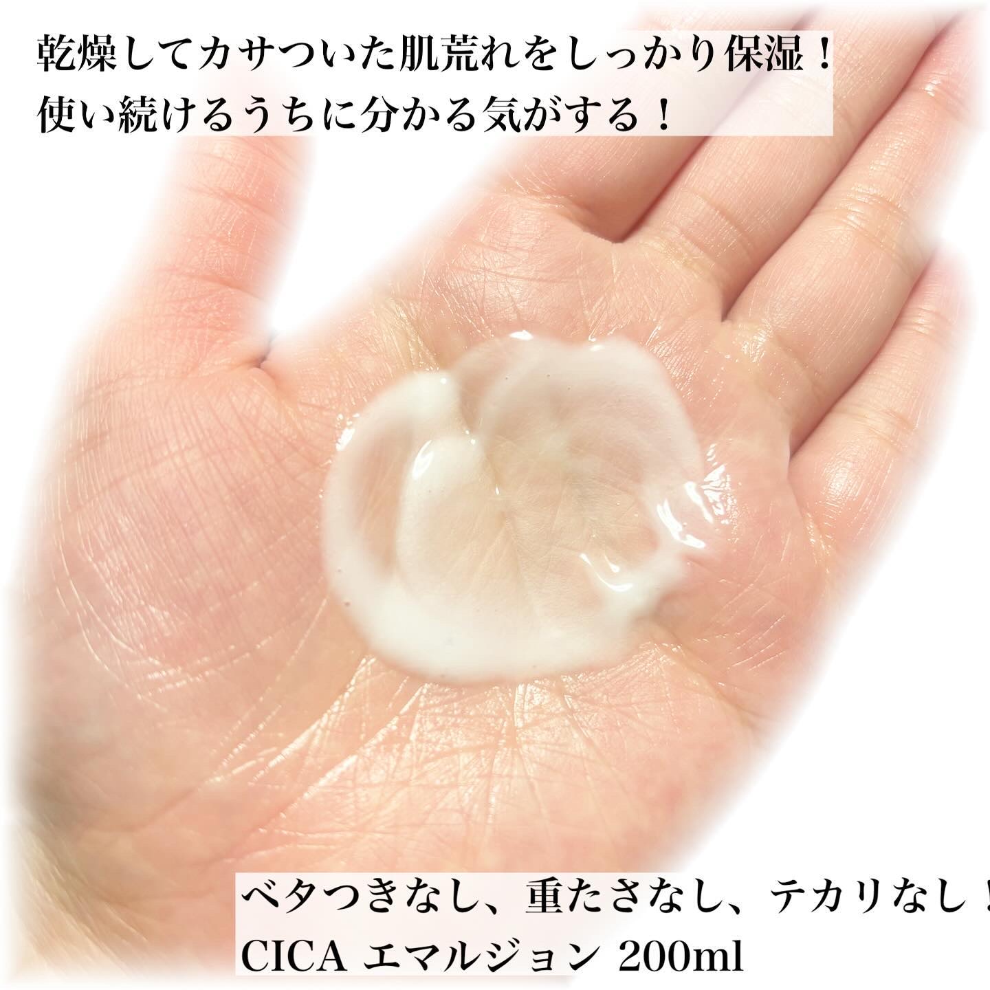 CICA エマルジョン/VT/乳液を使ったクチコミ（2枚目）
