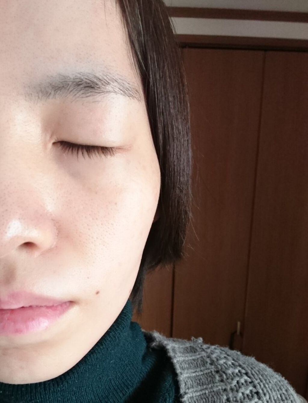 ティーツリースキンローション/ユーガ/化粧水を使ったクチコミ(6枚目)