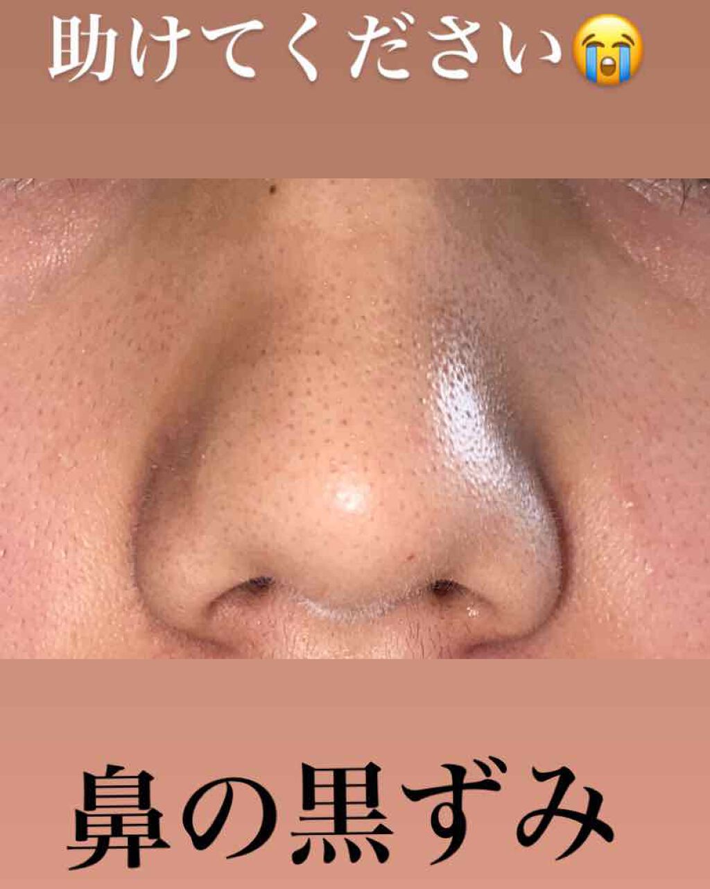 薬用 しみ 集中対策 美容液/メラノCC/美容液を使ったクチコミ（2枚目）