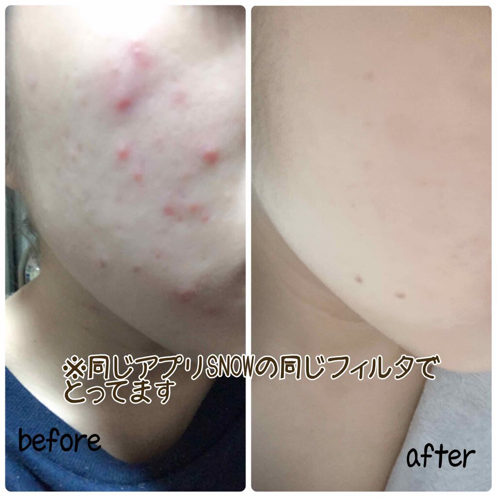 DHC はとむぎエキス/DHC/健康サプリメントを使ったクチコミ（2枚目）