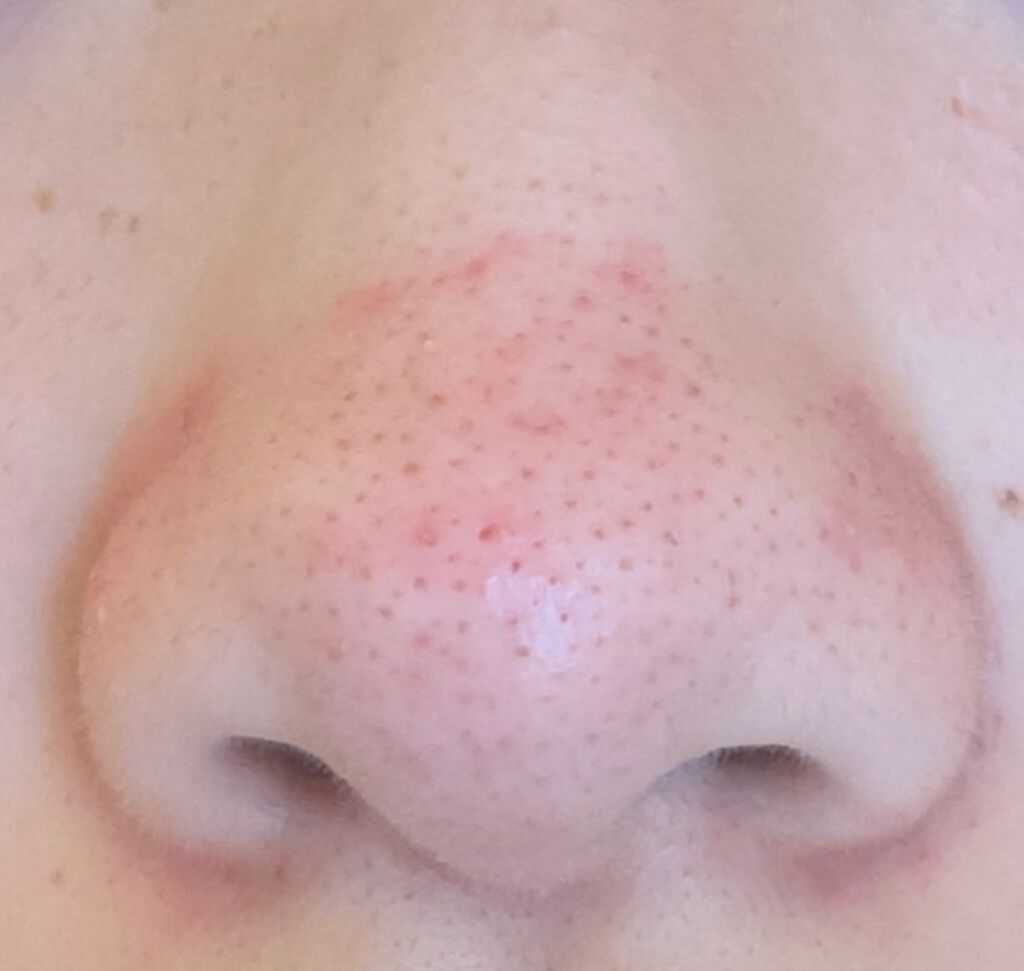 パーフェクトホワイトクレイ/SENKA（専科）/洗顔フォームを使ったクチコミ（2枚目）