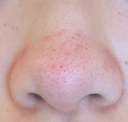 パーフェクトホワイトクレイ/SENKA(専科)/洗顔フォームを使ったクチコミ(2枚目)