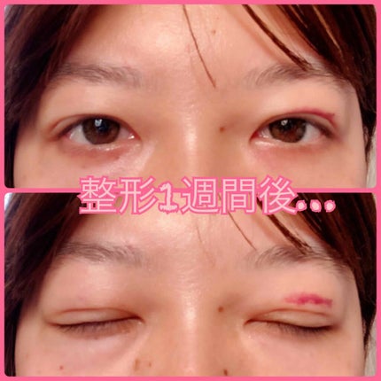 ê§ð¬¹â³ðŸððŸðð¶ð¬¹ê§ on LIPS ãâ ïžæŽåœ¢åŸã®åçãèŒããã®ã§ãèŠæãªæ¹ã¯æ³šæããŠãã ãã6æã«..ãïŒ2æç®ïŒ