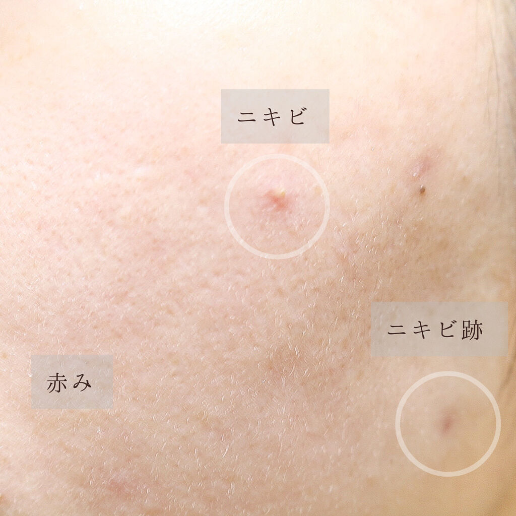 キル カバー フィクサー クッション/CLIO/クッションファンデーションを使ったクチコミ（3枚目）