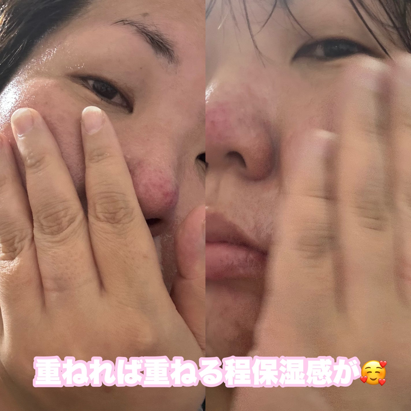 桃77%ナイアシンエッセンストナー 250ml/Anua/化粧水を使ったクチコミ(3枚目)