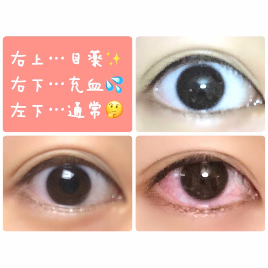 ロート リセ コンタクトa(医薬品)/ロート製薬/その他を使ったクチコミ（3枚目）