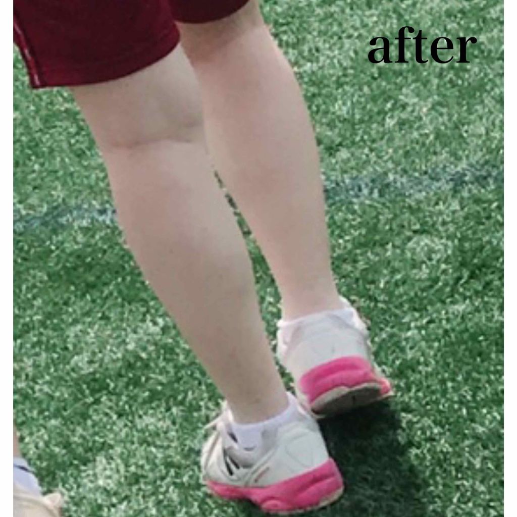 サンベアーズ アローバジェル/メンターム/美容液を使ったクチコミ(3枚目)