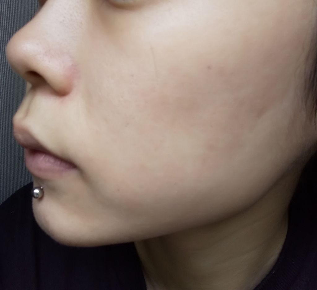 グリーンタンジェリン ビタC ダークスポットケアセラム/goodal/美容液を使ったクチコミ（2枚目）