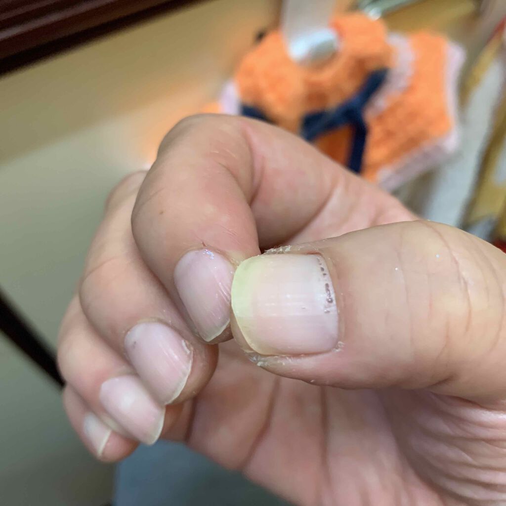 エルファー ネイルキッスA/DAISO/除光液を使ったクチコミ(3枚目)