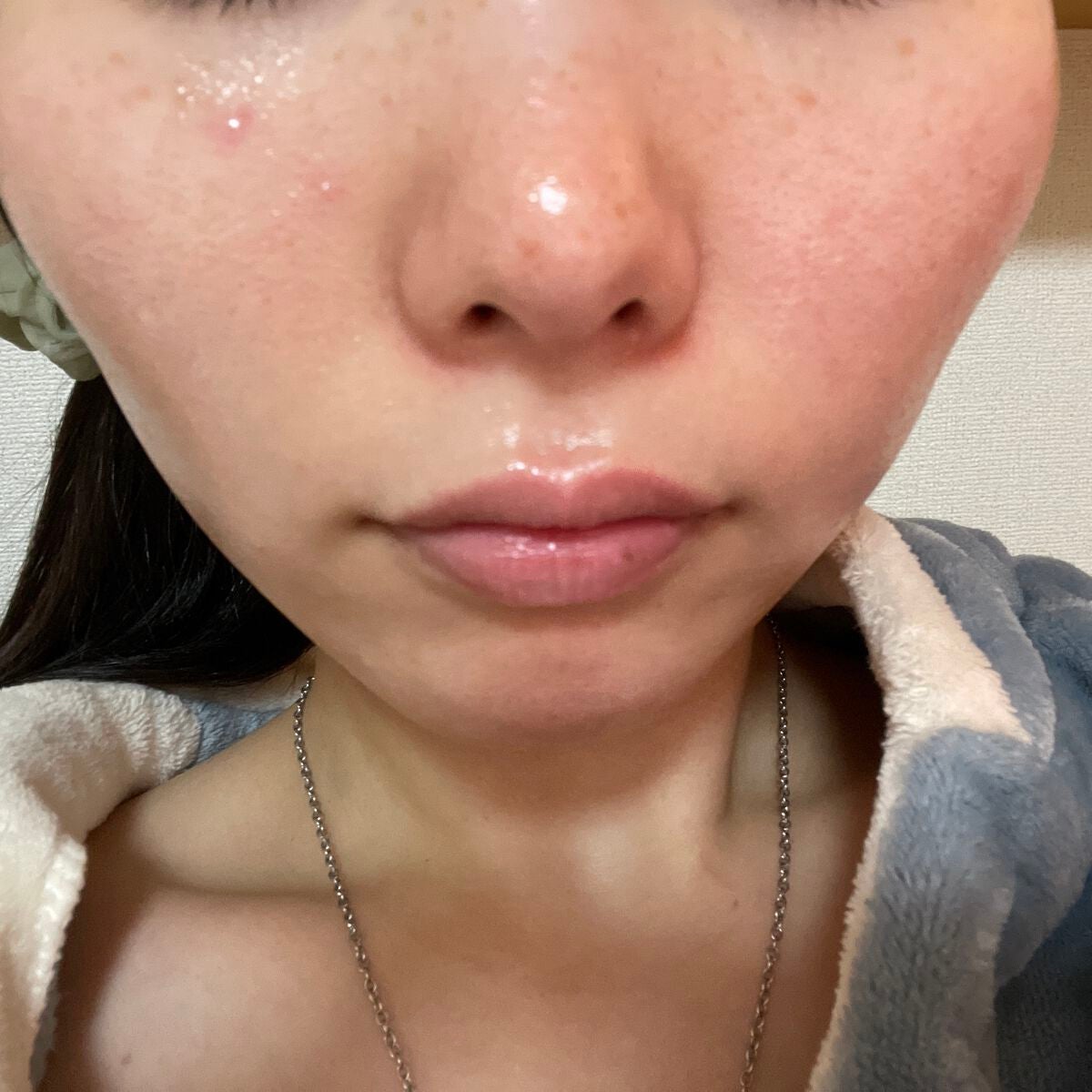 あんみつ on LIPS 「さあ〜〜クリスマスで暴飲暴食しまくったこの肌は何日で治るかな?..」(4枚目)