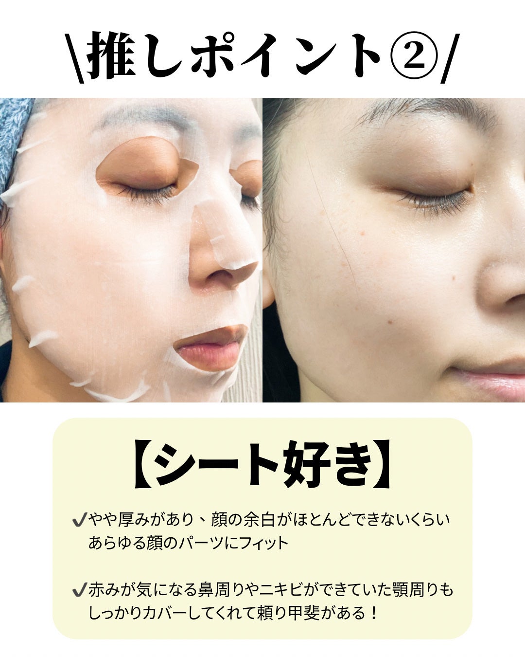 薬用ルルルン 美白アクネ/ルルルン/シートマスク・パックを使ったクチコミ(3枚目)