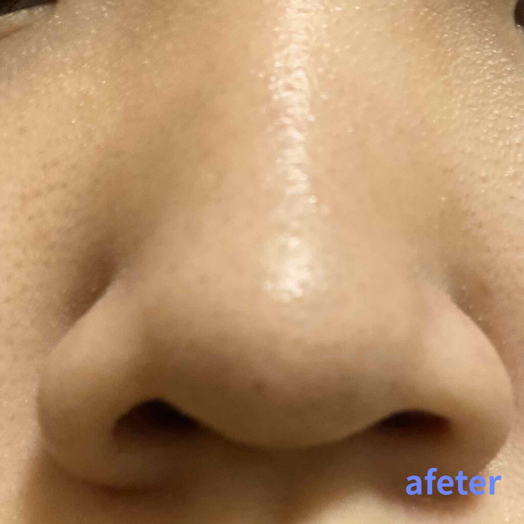 ソフティモ 薬用ホワイト クレンジングウォッシュ/ソフティモ/洗顔フォームを使ったクチコミ（2枚目）