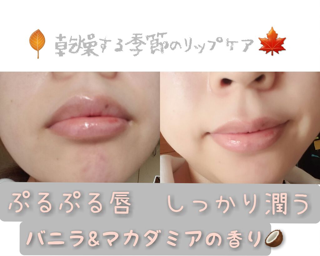 ニベア ディープモイスチャーリップ/ニベア/リップクリームを使ったクチコミ(1枚目)