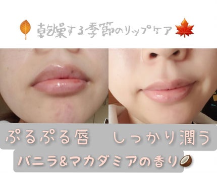 ニベア ディープモイスチャーリップ/ニベア/リップクリームを使ったクチコミ(1枚目)