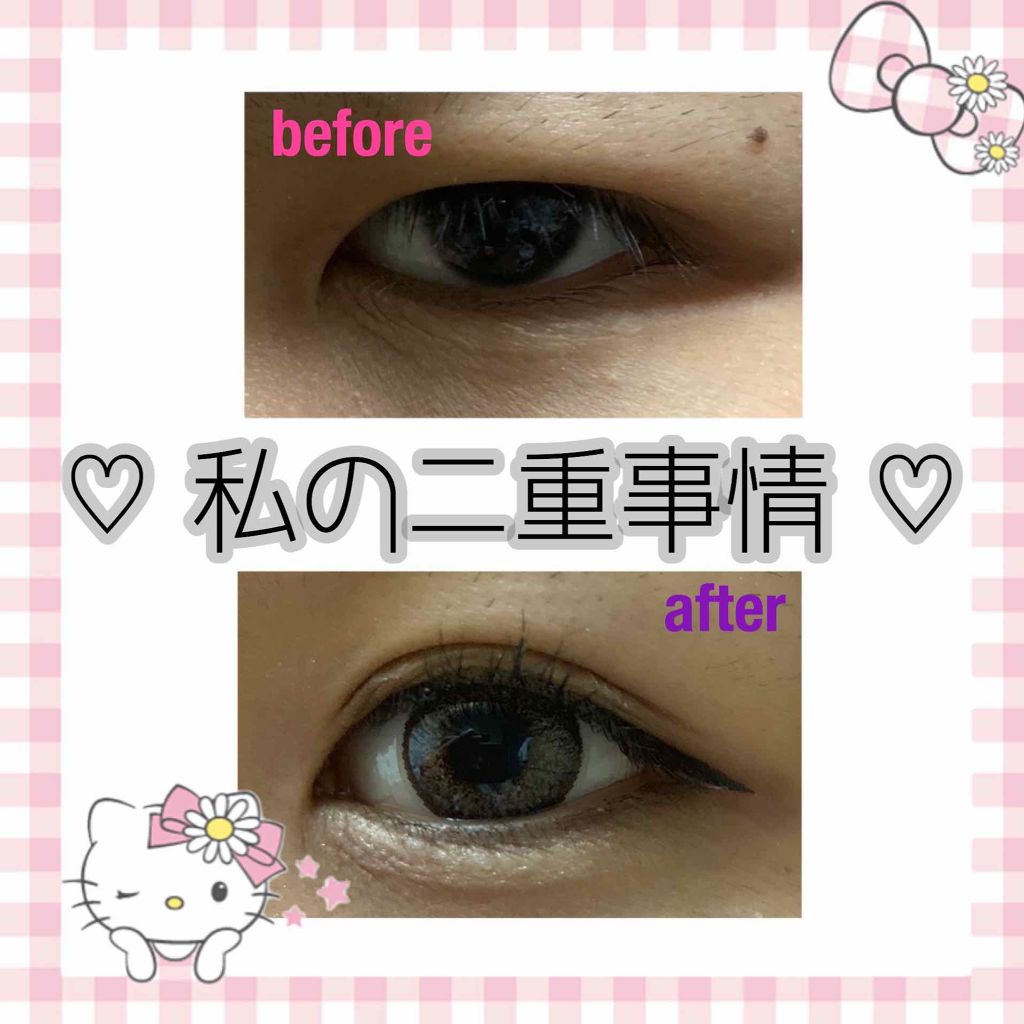 ふたえテープ 目立たず肌になじむ絆創膏タイプ/DAISO/二重まぶた用アイテムを使ったクチコミ（1枚目）