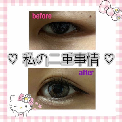 ふたえテープ 目立たず肌になじむ絆創膏タイプ/DAISO/二重まぶた用アイテムを使ったクチコミ(1枚目)