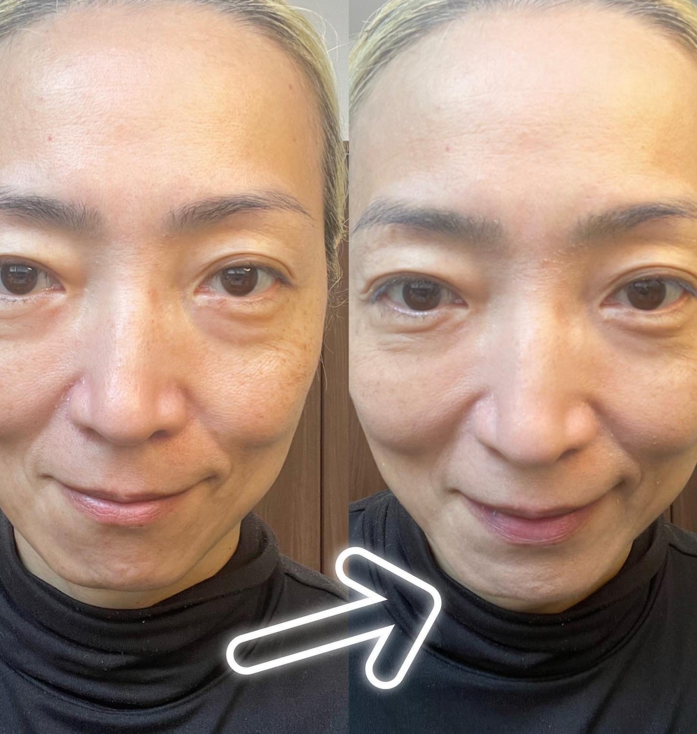 ritan on LIPS 「こんばんわ今日は韓国コスメで人気のtiftからtfitデリケー..」(4枚目)