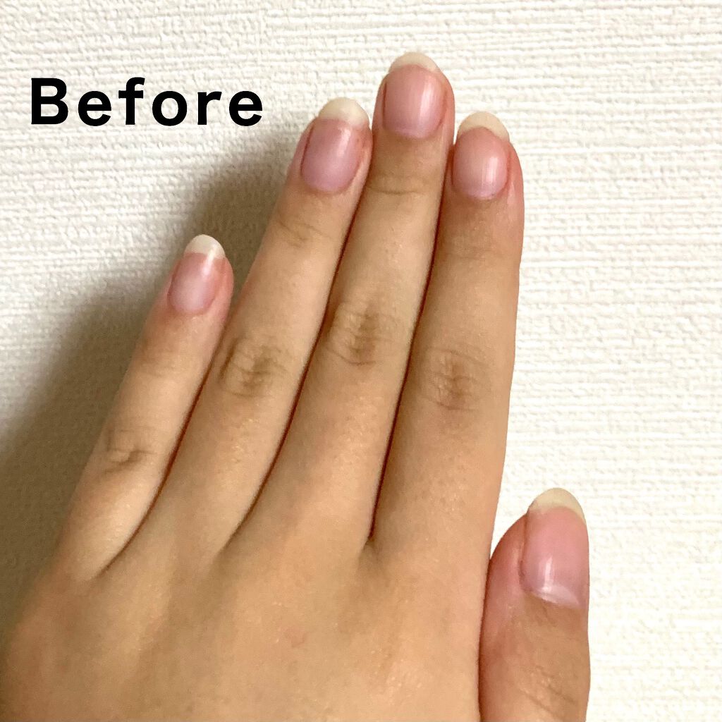 エテュセ クイックケアコート/ettusais/ネイルオイル・トリートメントを使ったクチコミ（2枚目）