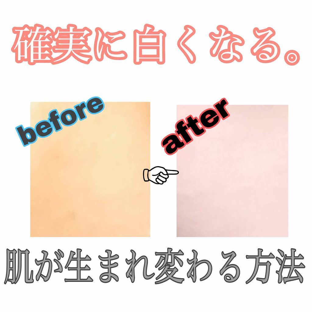 トランシーノ 薬用ホワイトニングエッセンスEX/トランシーノ/美容液を使ったクチコミ(1枚目)