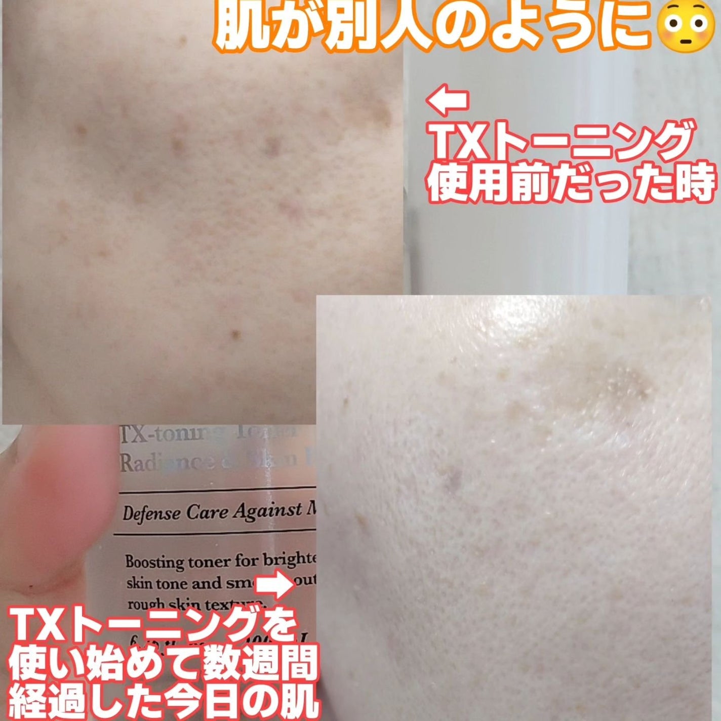 リードルショット300/VT/美容液を使ったクチコミ(2枚目)