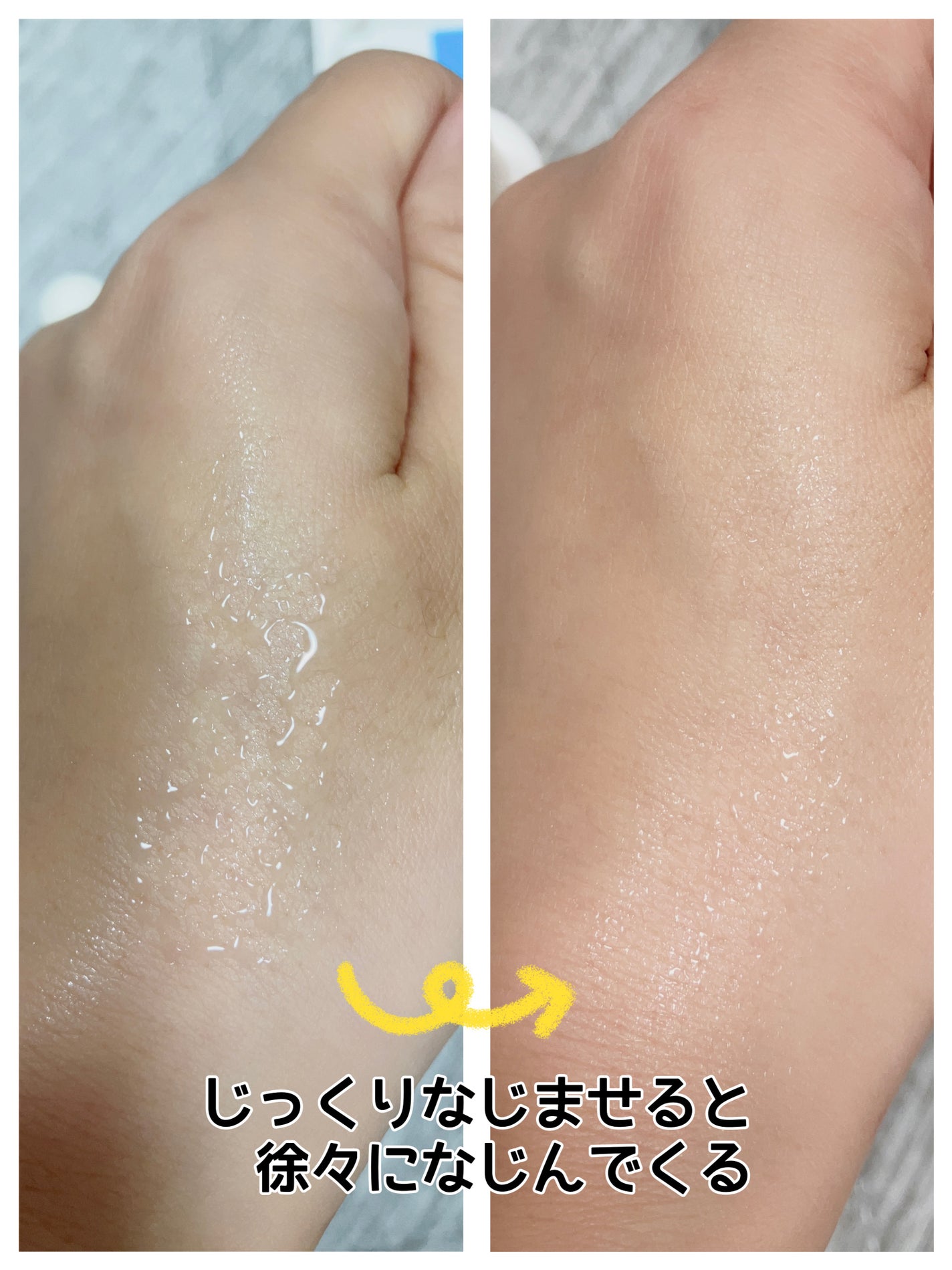 エファクラ ピールケア セラム/ラ ロッシュ ポゼ/美容液を使ったクチコミ(3枚目)