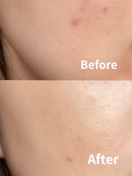 クッション ファンデーション/ANNA SUI/クッションファンデーションを使ったクチコミ(4枚目)