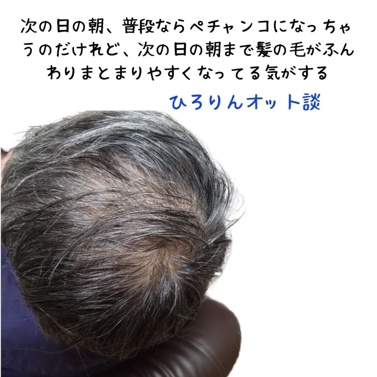 G4Uメディケアスカルプ/クルールラボ/頭皮ケアを使ったクチコミ（3枚目）