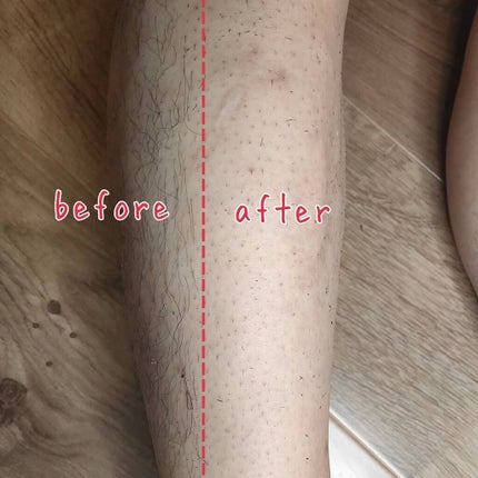 あたりちゃん♥️フォロバ&イイネ返し on LIPS 「仕上がりサロン級!ムダ毛を簡単除毛出来る『パイン&ソイメンズヘ..」(6枚目)