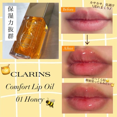 𝐦𝐚𝐲𝐮🧸🎀 on LIPS 「【カッサカサな汚い唇すみません😰】こんばんは~🌙今日は、#クラ..」（1枚目）